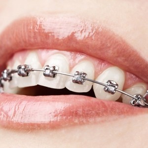 Zubní lékař – ortodoncie MDDr. Zuzana Hanuliaková, Ph.D.